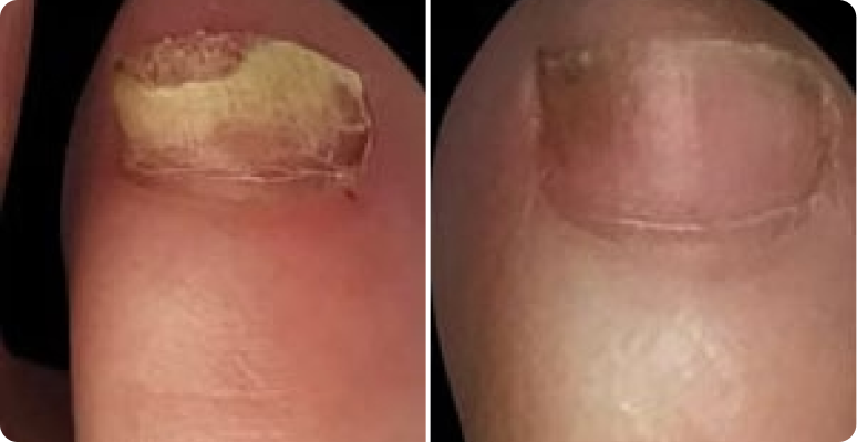 Günter Fischer before after