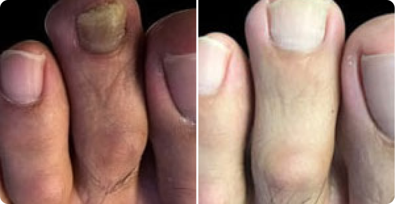 Renate Hoffmann before after