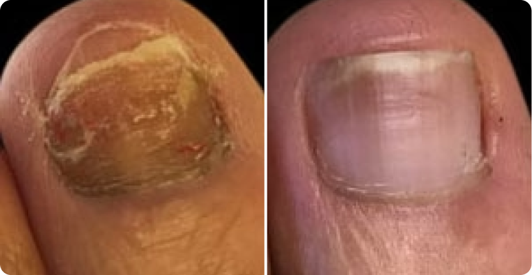 Wolfgang Becker before after